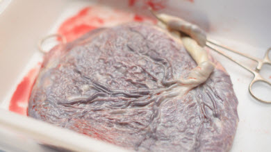 Le placenta doit maintenant être remis aux parents qui le demandent