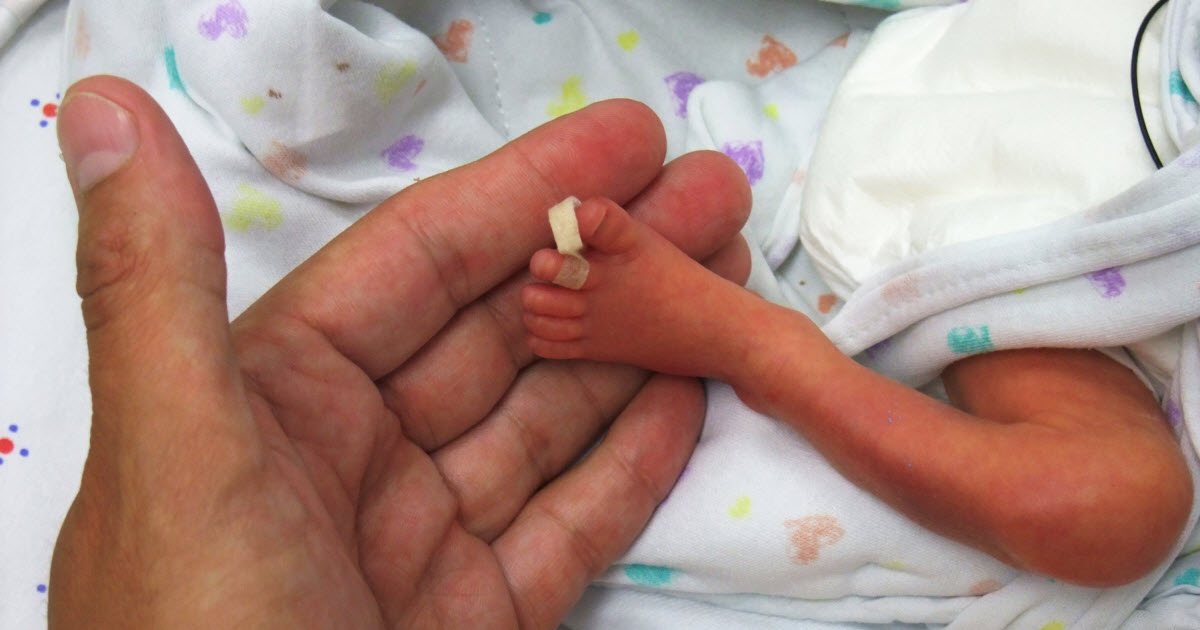 En manchettes: Bébés prématurés - Coronavirus - Allergies alimentaires