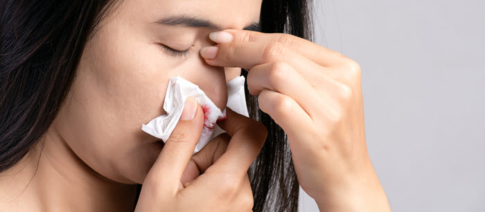 Pregnancy: Nosebleeds