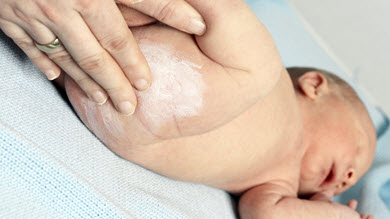 Fesses rouges: comment prévenir l'érythème fessier?